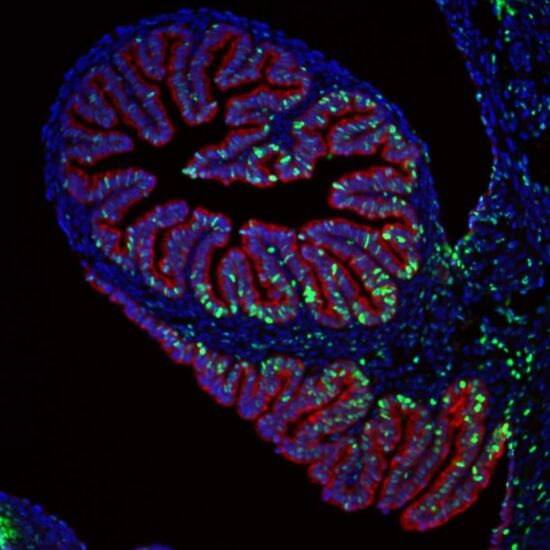 fallopian tube under a microscope